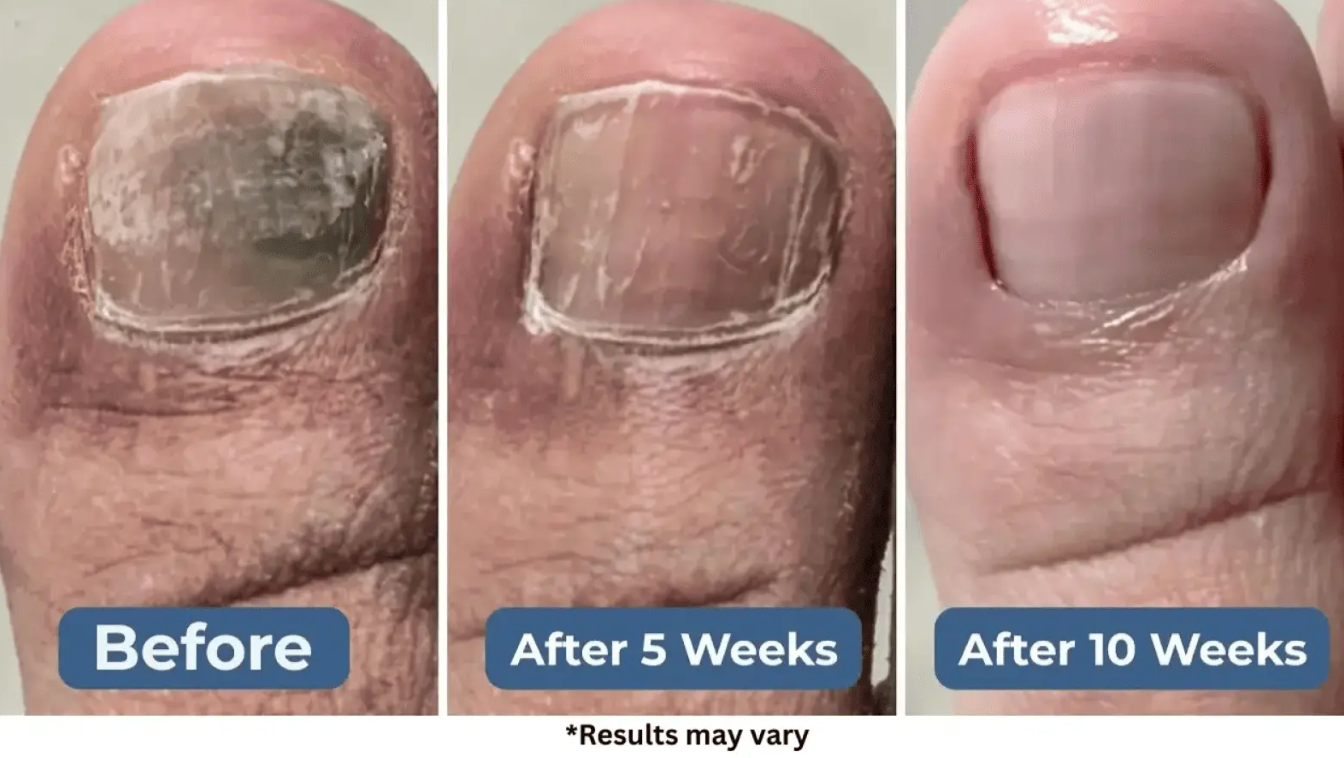 benefits of Lumora Beam